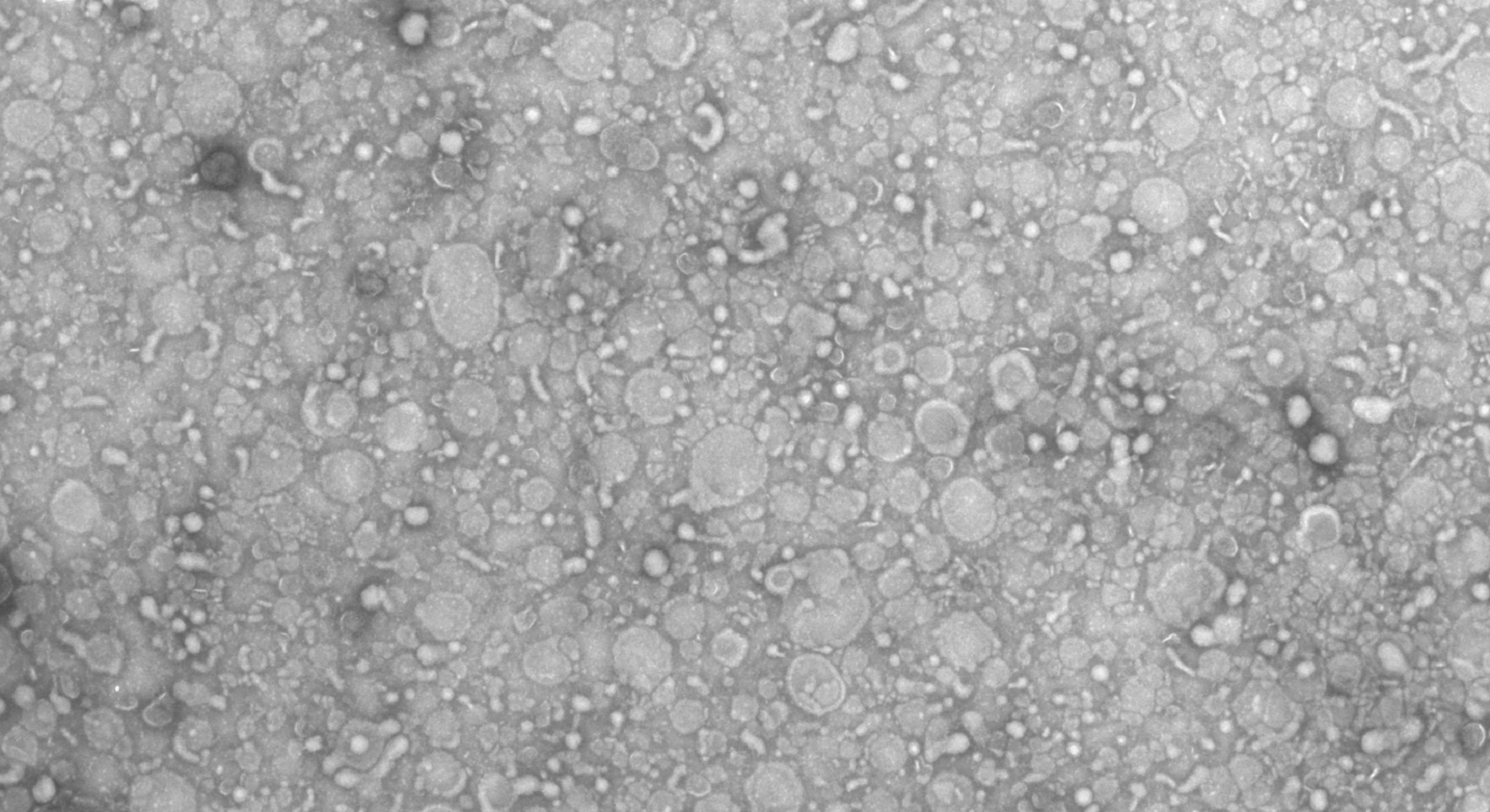 Extracellular vesicles in milk